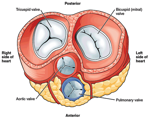 A damaged tricuspid valve (upper left) can leak,causing blood to flow back into the ventricle.