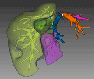 Liver segments are color-coded to map the architecture of hepatic veins