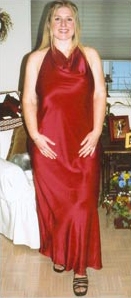 Lisa Goetze After Obesity Surgery, January 2004 