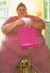 Lisa Goetze Before Obesity Surgery, August 2000