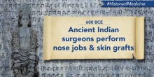 Ancient Indian Nose Jobs