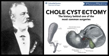 The Galling Gallbladder