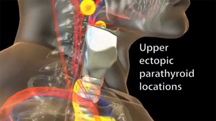 Video Thumbnail: Where are the Parathyroid Glands?